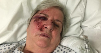 lady after fall