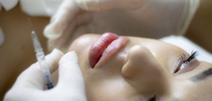 dermal filler