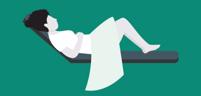 cervical screening