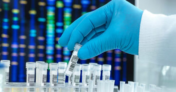 DNA relationship test