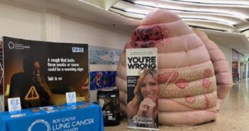 lung cancer