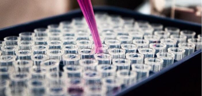 Infectious Disease Research