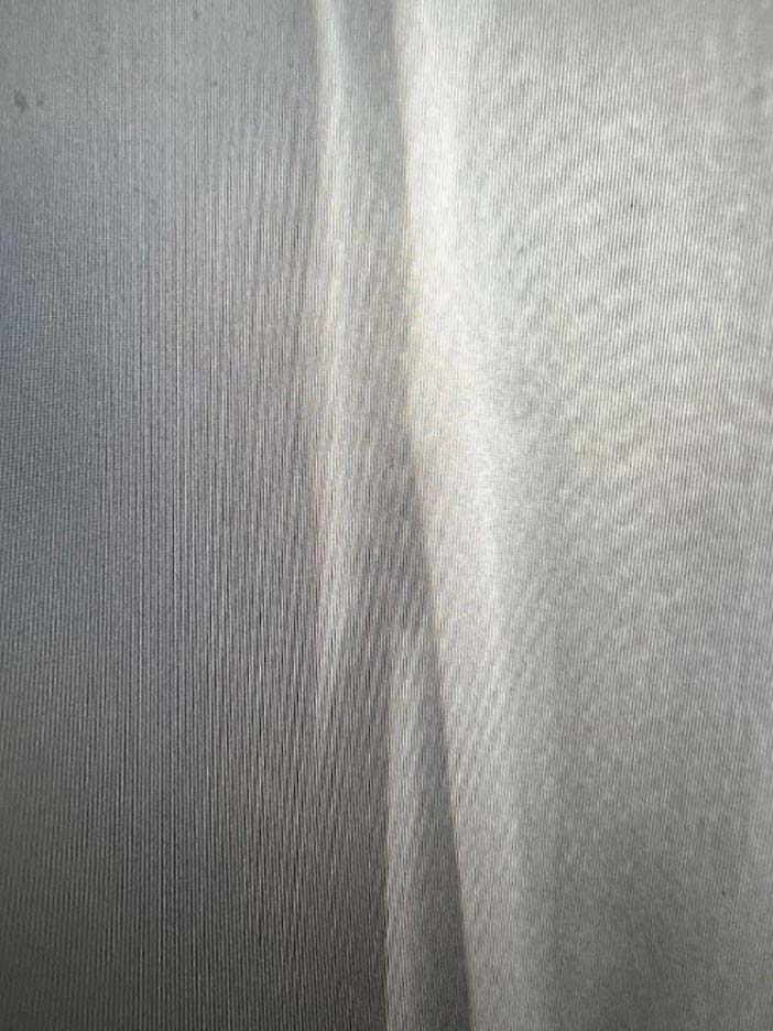 ankle