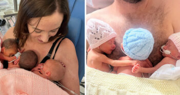 neonatal
