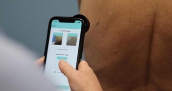skin cancer